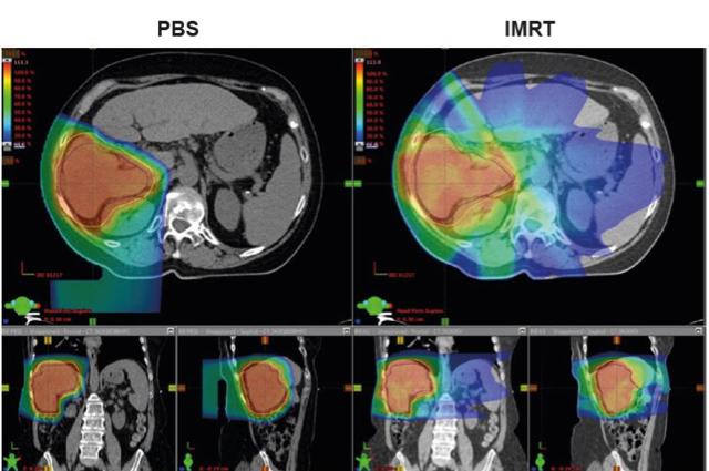 gastrointestinal malignancy